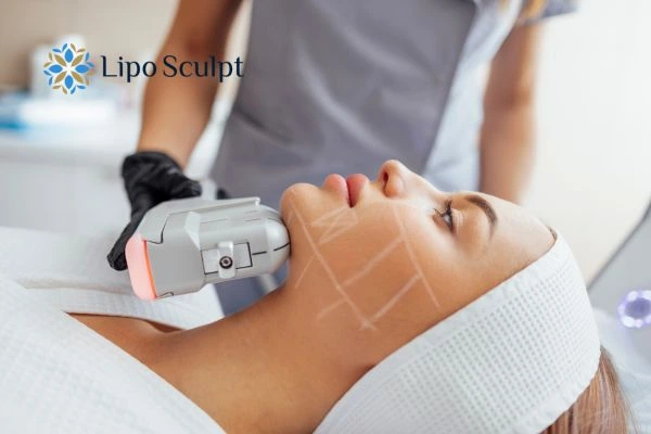 HIFU vs Botulinum Toxin: Understanding the Differences 1 HIFU vs Botox Clifton What is the best option for you?
