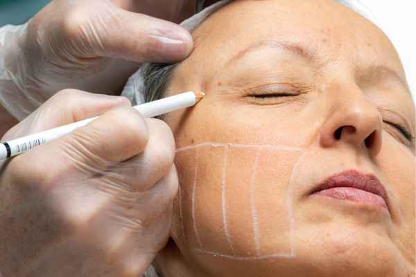 CryoPen: 5 Skin Concerns It May Be Used to Treat 4 What should you ask before having CryoPen treatment Clifton?